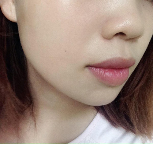 Da trắng bóc lỗ chân lông biến mất 99% khi dùng viên Vitamin E đúng cách - 5