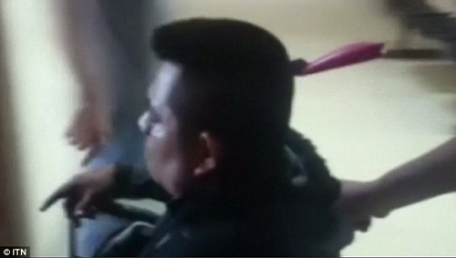 Dao đâm xuyên đầu vẫn ung dung vào viện nói chuyện với bác sỹ - 2