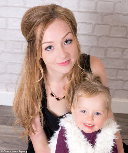 #039;Nụ hôn thần chết#039; khiến bé gái 2 tuổi bị lở loét, đau đớn suốt 8 tháng trời - 4