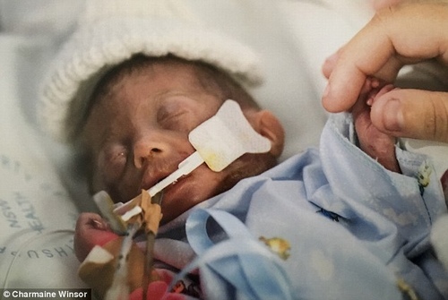 Hình ảnh 7 ngày cuối cùng của bé trai mắc hội chứng truyền máu song thai gây xúc động - 4