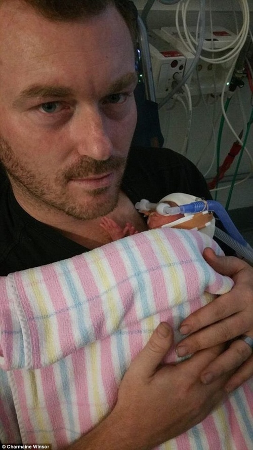 Hình ảnh 7 ngày cuối cùng của bé trai mắc hội chứng truyền máu song thai gây xúc động - 6