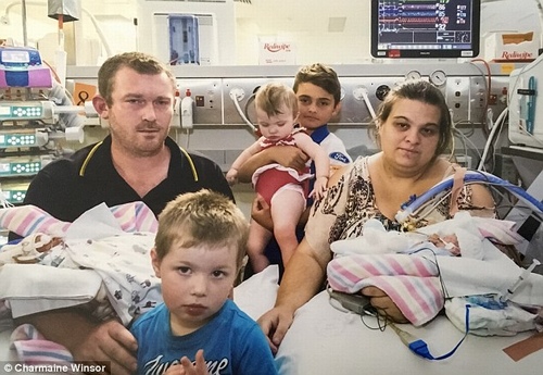 Hình ảnh 7 ngày cuối cùng của bé trai mắc hội chứng truyền máu song thai gây xúc động - 7