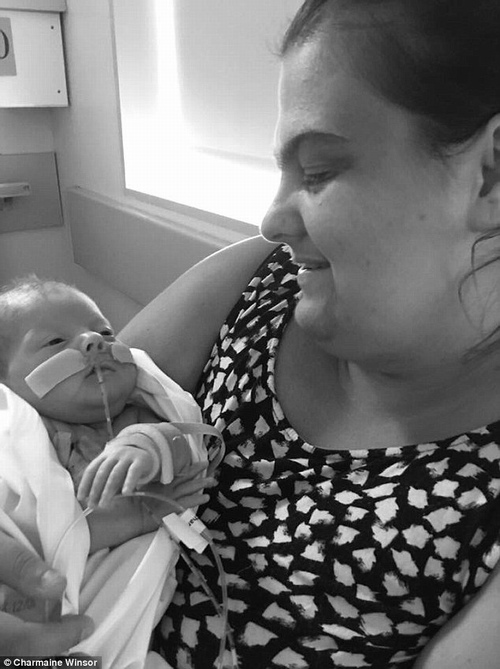 Hình ảnh 7 ngày cuối cùng của bé trai mắc hội chứng truyền máu song thai gây xúc động - 8