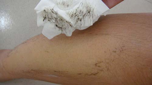 Biết hết 7 công dụng này của oxy già, 99% chị em chạy đi mua chúng ngay lập tức - 3