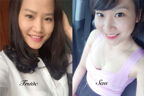 Biết hết 7 công dụng này của oxy già, 99% chị em chạy đi mua chúng ngay lập tức - 4