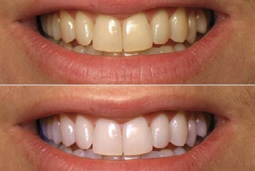 Biết hết 7 công dụng này của oxy già, 99% chị em chạy đi mua chúng ngay lập tức - 5