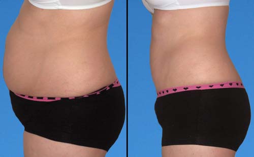 Chế biến chanh theo cách dưới đây, giảm ngay 10kg chẳng có gì khó - 6