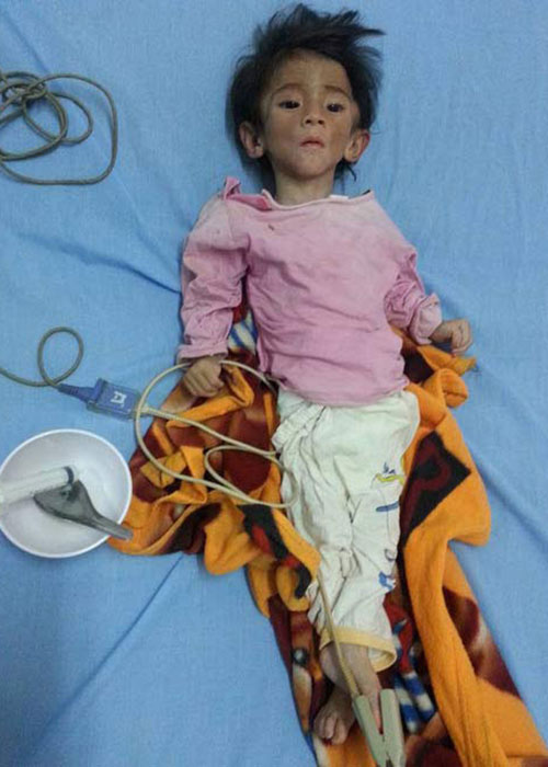 Sự giống nhau kỳ lạ của bé gái Lào Cai 3,5kg và mẹ nuôi 9x khi cùng 15 tháng tuổi - 2