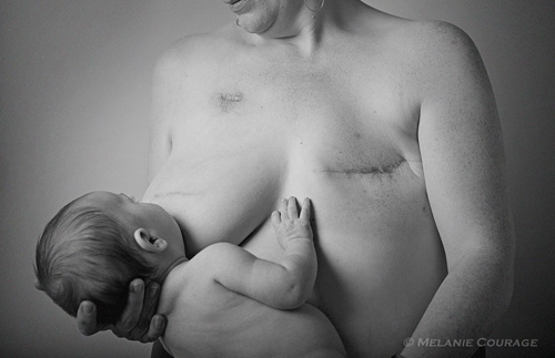 Sinh con: Ít ai dũng cảm như bà mẹ một bên ngực bị cắt vẫn khoe ảnh cho con  bú