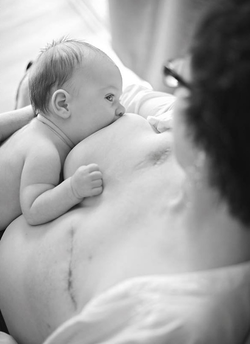 Sinh con: Ít ai dũng cảm như bà mẹ một bên ngực bị cắt vẫn khoe ảnh cho con  bú