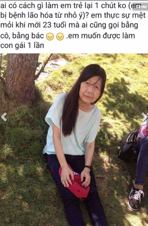 Cô gái 21 tuổi đau khổ khi mang gương mặt như cụ bà 81 - 3