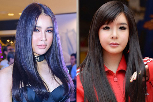 Trước Diệp Lâm Anh, những sao Việt nào từng gây xôn xao với khuôn mặt đơ cứng - 4