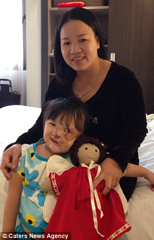 Cuộc sống mới của bé Việt mang khối u nửa khuôn mặt được nhà hảo tâm người Mỹ cứu sống - 4