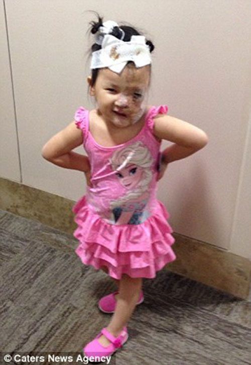 Cuộc sống mới của bé Việt mang khối u nửa khuôn mặt được nhà hảo tâm người Mỹ cứu sống - 7