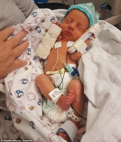 Mang bầu bị cảm cúm, mẹ trẻ amp;#34;chết lặngamp;#34; khi sinh con ra dị tật thế này - 3