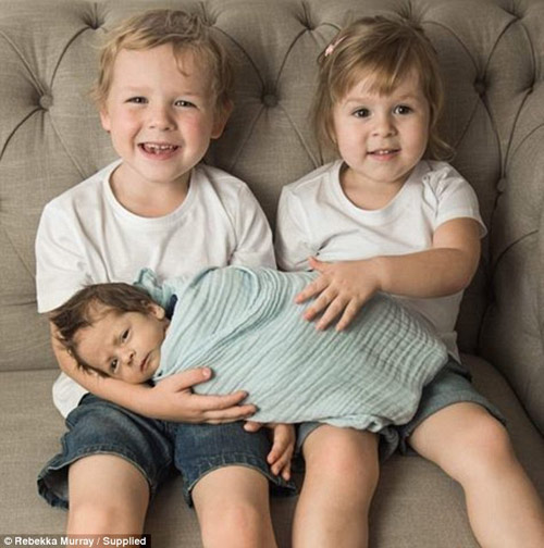 Mang bầu bị cảm cúm, mẹ trẻ amp;#34;chết lặngamp;#34; khi sinh con ra dị tật thế này - 5