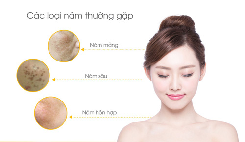 Làm sao sạch nám sáng da, đón đầu vận may mừng năm mới? - 3