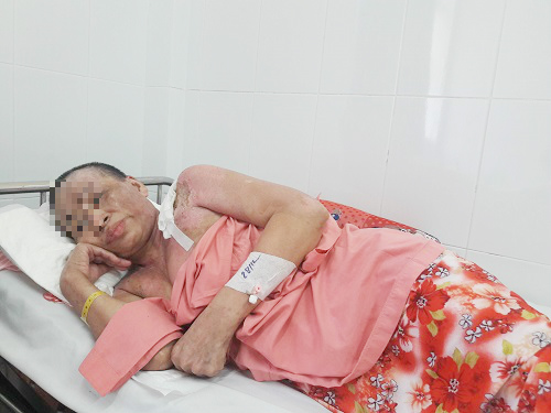 Không chịu móc cống tắc, người phụ nữ bị đồng nghiệp tạt nguyên cả nồi thịt kho đang sôi - 3