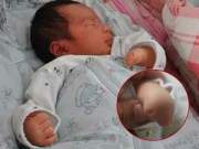 Bà bầu - Con sinh ra không có ngón tay, biết nguyên nhân mẹ ôm đầu hối hận