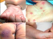 Sức khỏe - "Bí quyết" đơn giản phòng bệnh tay chân miệng không phải ai cũng biết