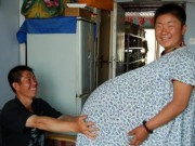 Bà bầu - Choáng với bụng bầu "to khủng khiếp" của mẹ mang thai năm, 55 triệu ca mới có một