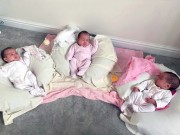 Bà bầu - Kỳ diệu ca sinh mổ 3 thai với một bé nằm nguyên trong bọc ối