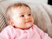 Làm mẹ - Mẹo trị ọc sữa cho trẻ sơ sinh và trẻ nhỏ mà nhiều mẹ chưa biết