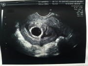 Bà bầu - Thai nhi 5 tuần tuổi đã vào tử cung chưa?