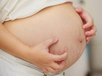 Mang thai 35 tuần bị ngứa có nên dùng thuốc không?