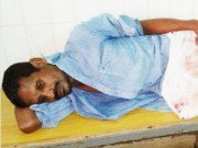 Tin tức - Chồng bị vợ cắt phăng "của quý" vì đòi "yêu"