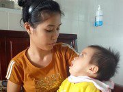 Tin tức - Bé gái 13 tháng tuổi bị teo não, nhiễm trùng máu vì bị côn trùng đốt vào tai