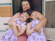 Làm mẹ - Cuộc sống của cặp song sinh liền đầu biết mọi suy nghĩ của nhau nhưng tính cách trái ngược