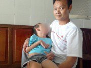 Tin tức - Chủ quan với cơn sốt cao co giật, bé trai 7 tuổi phải sống đời thực vật