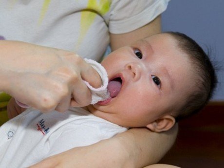 Lưỡi bé bị đóng trắng là do mắc bệnh gì?