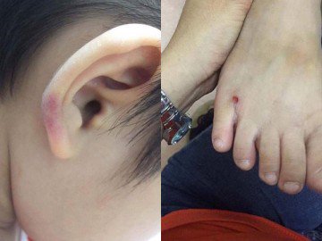 Phẫn nộ trước cảnh cô giáo mầm non hành hạ con riêng của chồng ở Hà Nội