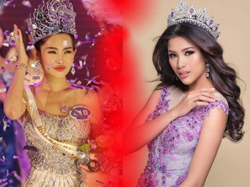Bị Tân Hoa hậu Đại dương khơi lại vụ làm răng, Nguyễn Thị Thành bức xúc đáp trả