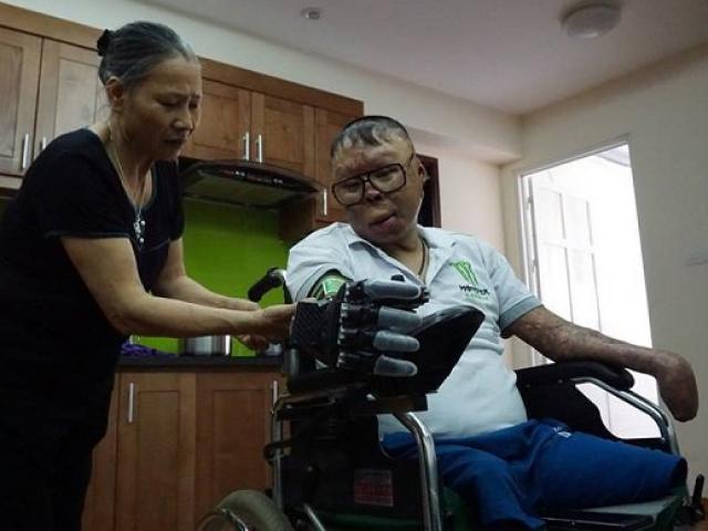Cuộc sống mới của chiến sĩ sống sót trong vụ trực thăng rơi ở HN khi có bàn tay giả