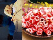 Làm đẹp - Danh sách đen những món tuyệt đối không đụng tới sau khi trải qua phẫu thuật thẩm mỹ