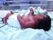 Bà bầu - Nằm viện giữ thai suốt 7 tháng, siêu âm bình thường, bà mẹ chết lặng khi sinh con dị tật