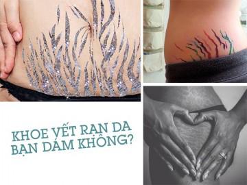 Thi nhau khoe vết rạn da trên Instagram: trào lưu sốt 100 độ của hội chị em!