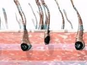 Làm đẹp - Đã sạch lông lại được trắng da nhờ phương pháp triệt lông bằng laser
