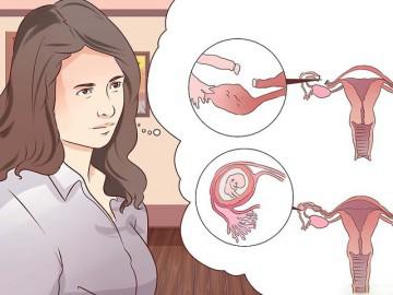 Thai ngoài tử cung có giữ được không?
