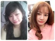 Làm đẹp - Nhật kí cắt mí mắt của cô nàng 9x từng lo sợ mắt sẽ bị "trợn" sau phẫu thuật!