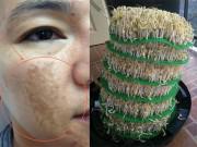 Làm đẹp - Ghi ngay vào sổ tay những cách trị nám, tàn nhang với công thức cực độc tại nhà!