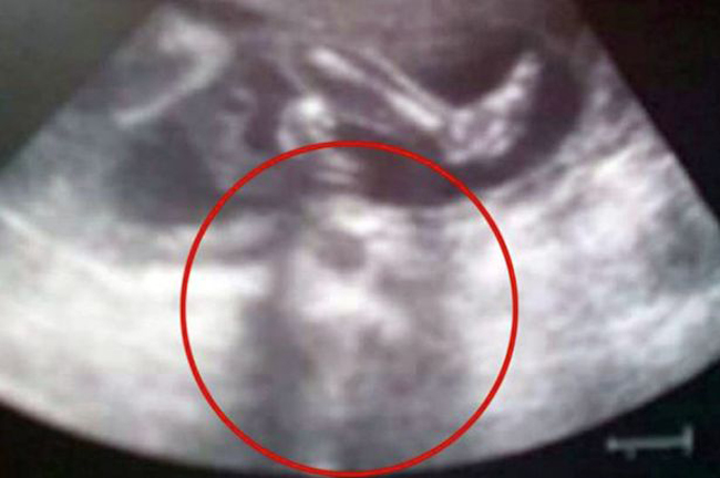 Hình ảnh Chúa Jesus xuất hiện trong hình ảnh siêu âm thai nhi.
