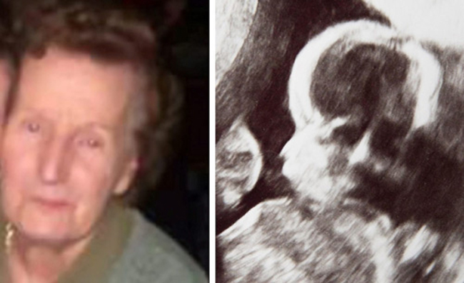 Không ai có thể phủ nhận sự xuất hiện của khuôn mặt người bà trong bức ảnh siêu âm thai.
