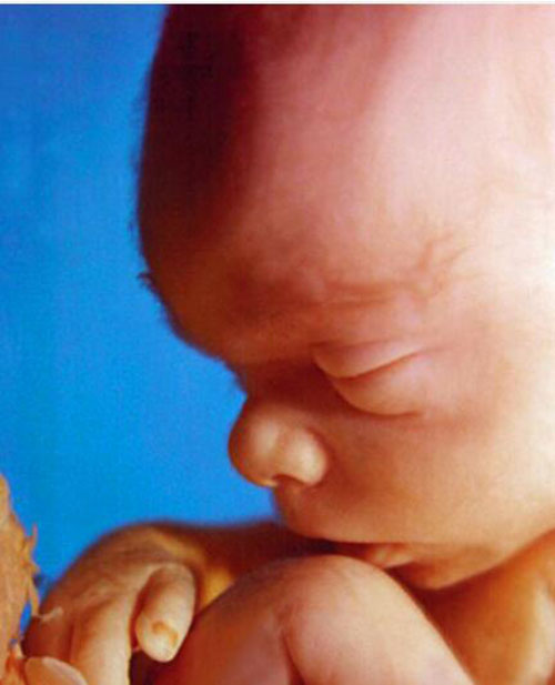 Những bức ảnh siêu âm rõ từng centimet khiến bác sĩ cũng phải giật mình - 1