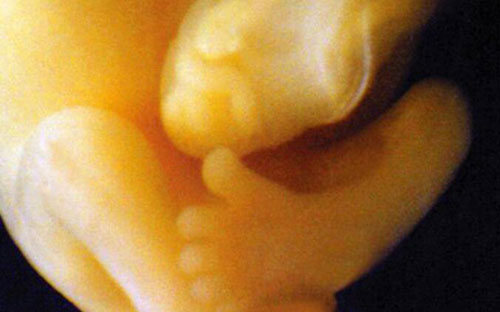 Những bức ảnh siêu âm rõ từng centimet khiến bác sĩ cũng phải giật mình - 5