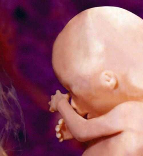 Những bức ảnh siêu âm rõ từng centimet khiến bác sĩ cũng phải giật mình - 4
