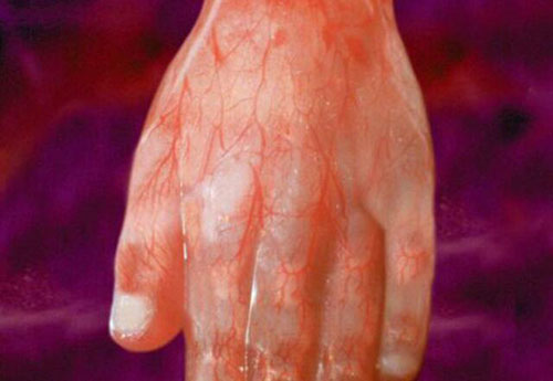 Những bức ảnh siêu âm rõ từng centimet khiến bác sĩ cũng phải giật mình - 3